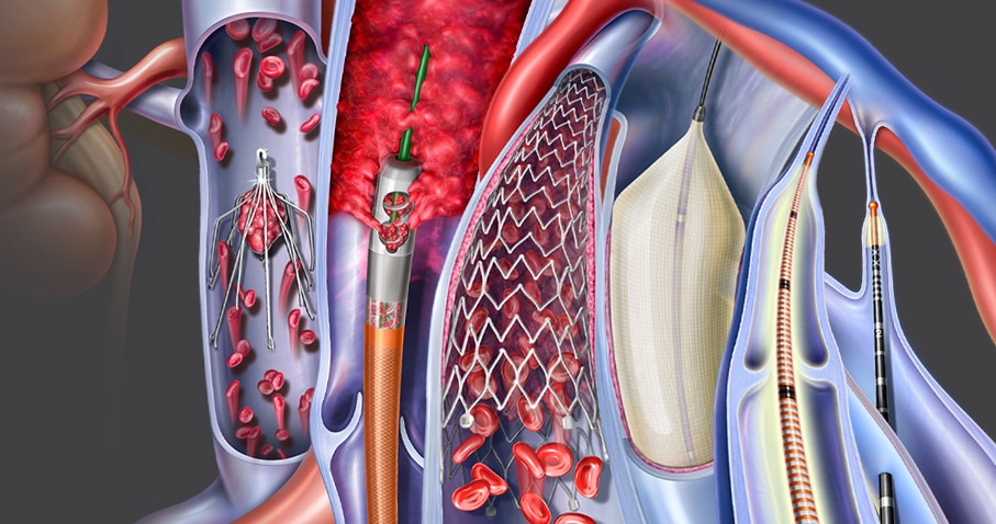 BD-81204_Venous_Products_Grouped_907x478.jpg
